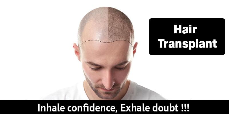 Hair Transplant