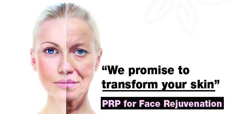 PRP for Face Rejuvenation