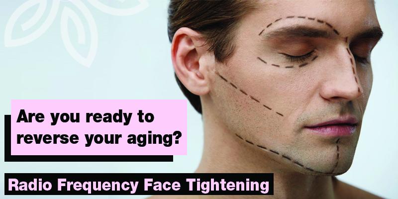 Radio Frequency Face Tightening