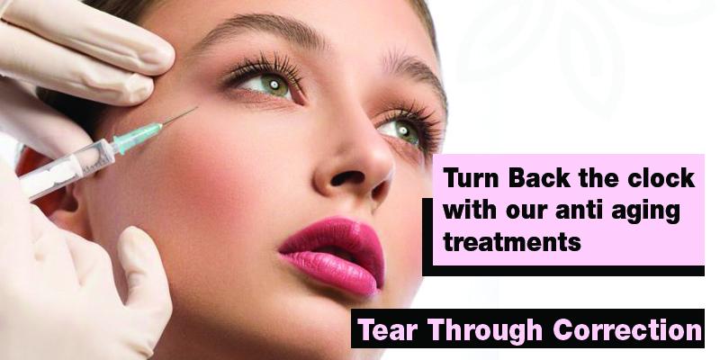 Tear Through Correction